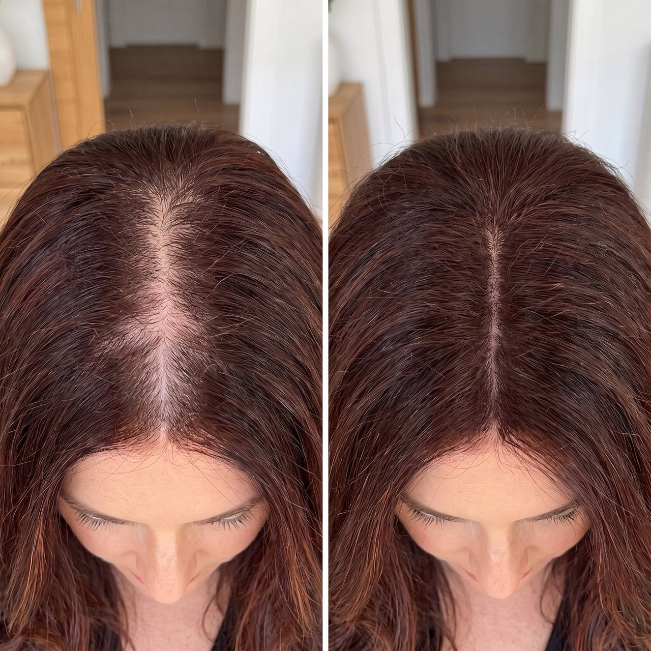 Sarah M. before and after