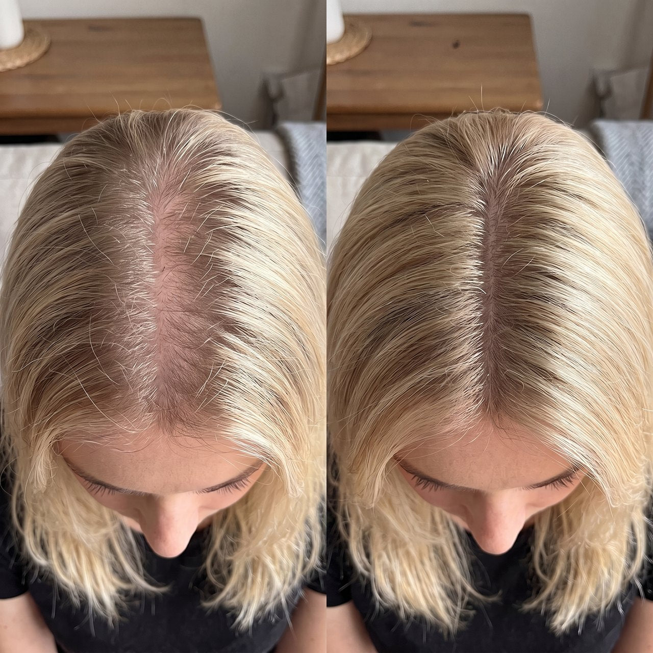 Jessica R. before and after
