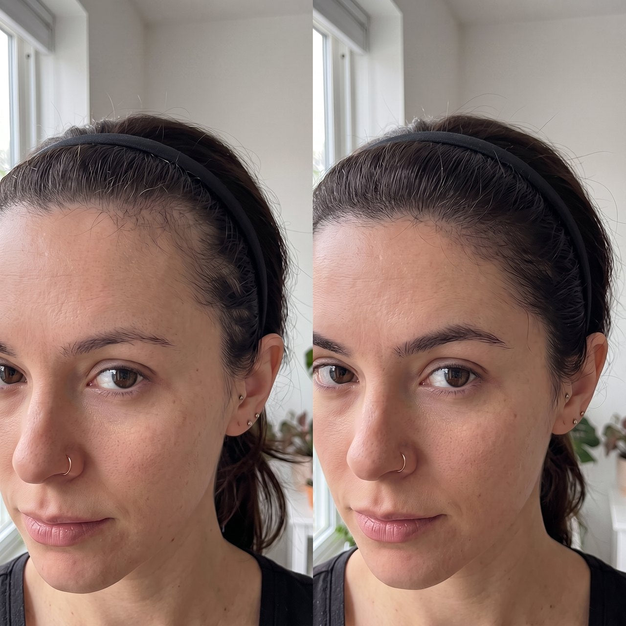 Rachel K. before and after