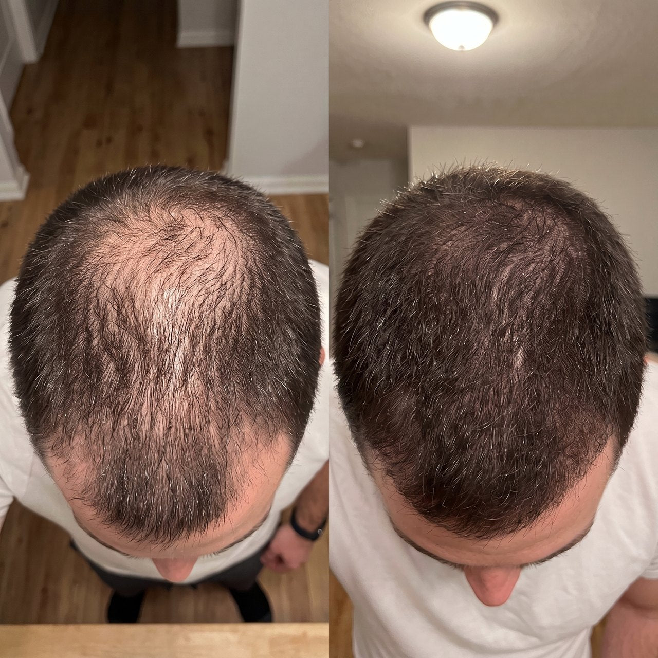 Michael T. before and after